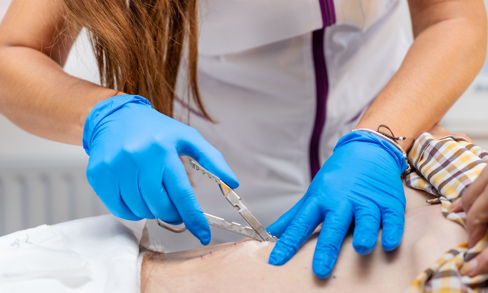 Infermiere che utilizza un kit levapunti sterile per la rimozione di punti di sutura metallici a domicilio